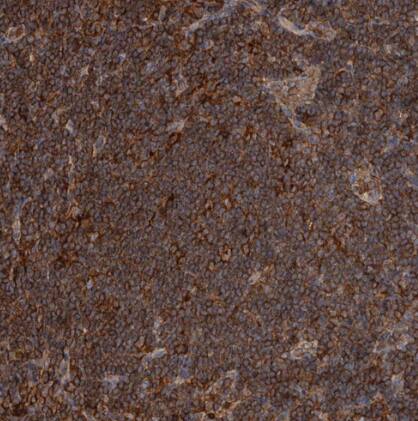 ADCK4 Antibody - BSA Free