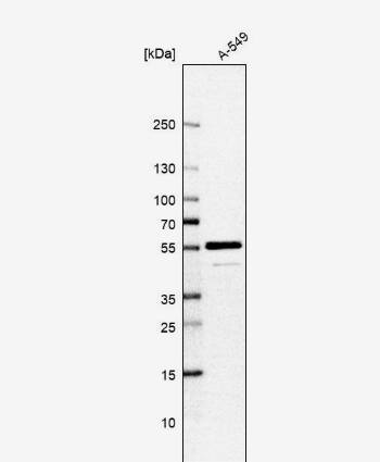 ADCK4 Antibody - BSA Free ADCK4 Antibody [NBP1-85510] -