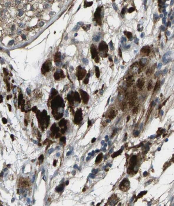 CTR2 Antibody - BSA Free