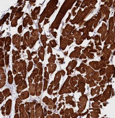 Rapsyn Antibody