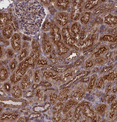 Clathrin interactor 1 Antibody
