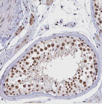 MOSPD3 Antibody