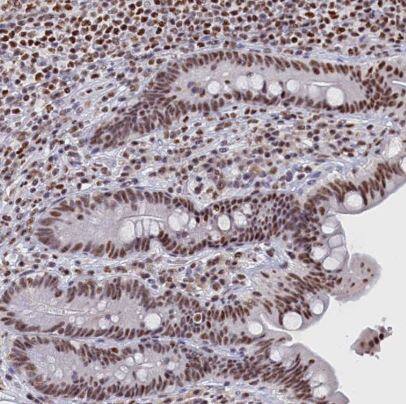 MOSPD3 Antibody