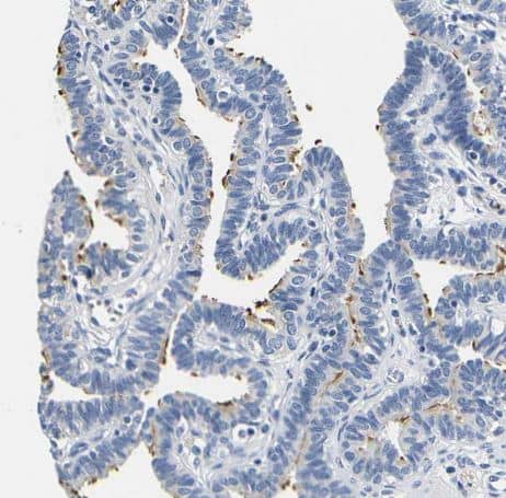 CD42b/GPIb alpha Antibody