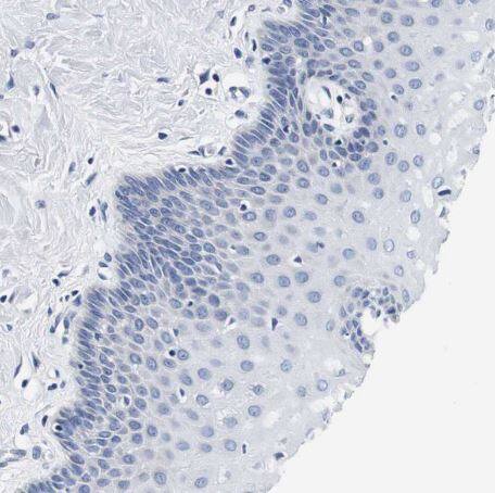 CD42b/GPIb alpha Antibody
