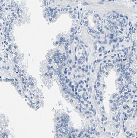 CD42b/GPIb alpha Antibody