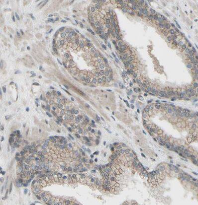 CDCP1 Antibody