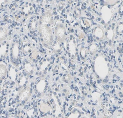 CD23/Fc epsilon RII Antibody