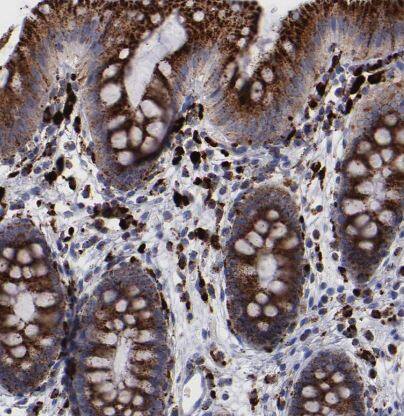 Cathepsin S Antibody