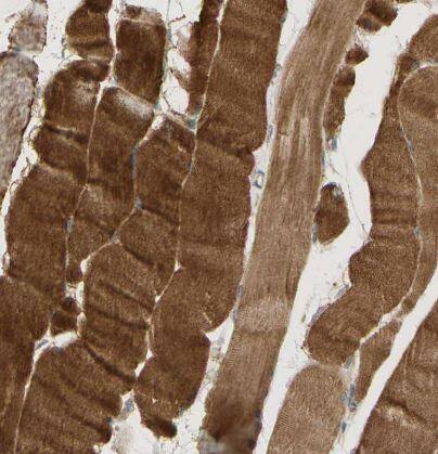 TACE/ADAM17 Antibody