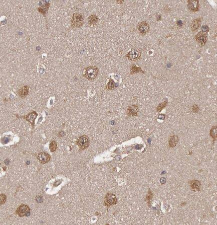 USP14 Antibody