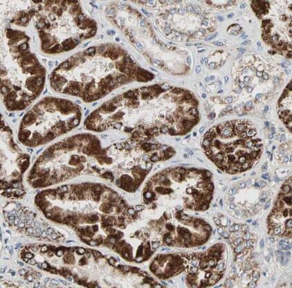 TST Antibody - BSA Free