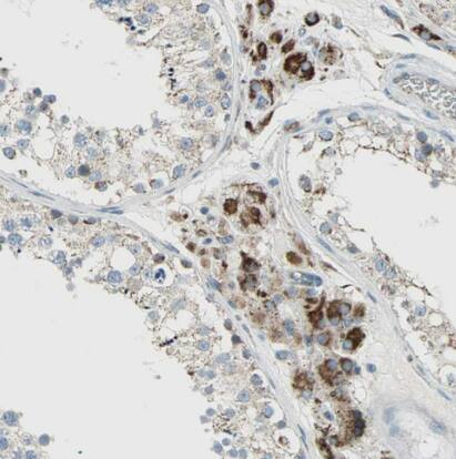 TST Antibody - BSA Free