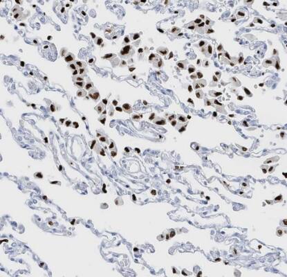 MNDA Antibody - BSA Free