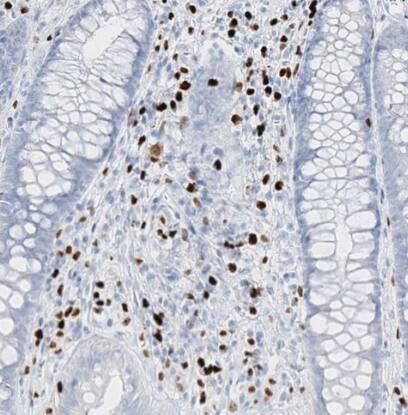 MNDA Antibody - BSA Free