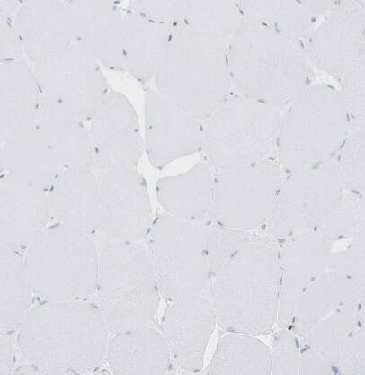MNDA Antibody - BSA Free
