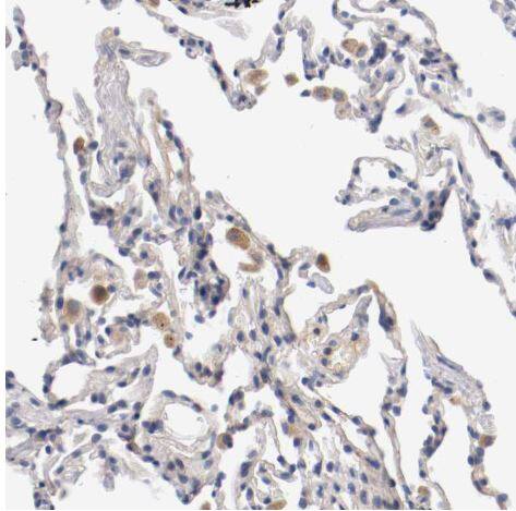 PACE4/PCSK6 Antibody
