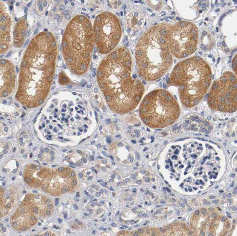 PACE4/PCSK6 Antibody