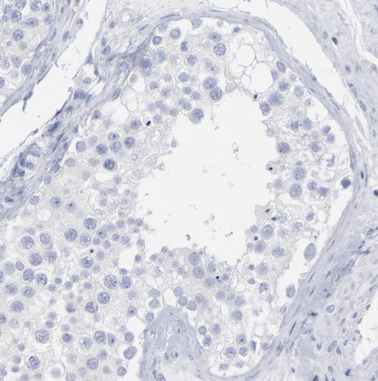 P2Y8 Antibody - BSA Free