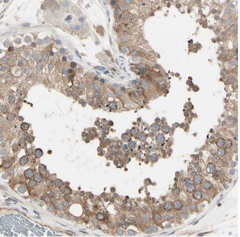Nesfatin-1/Nucleobindin-2 Antibody