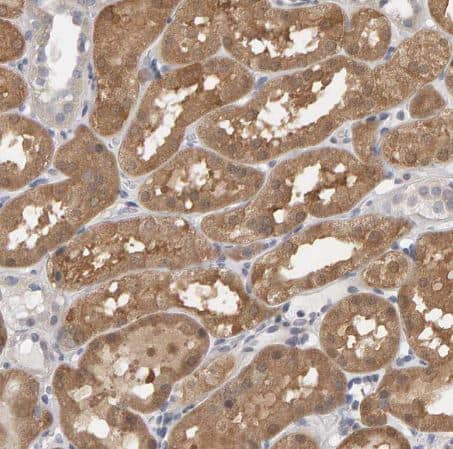 Methionine Sulfoxide Reductase A Antibody