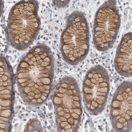 Methionine Sulfoxide Reductase A Antibody