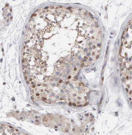 Methionine Sulfoxide Reductase A Antibody