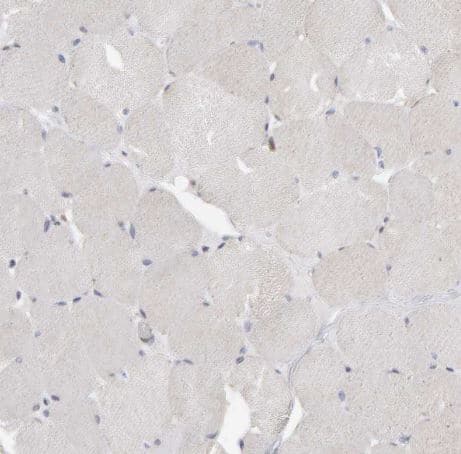 Methionine Sulfoxide Reductase A Antibody