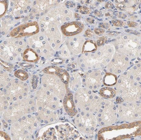 Aldolase A Antibody Aldolase A Antibody