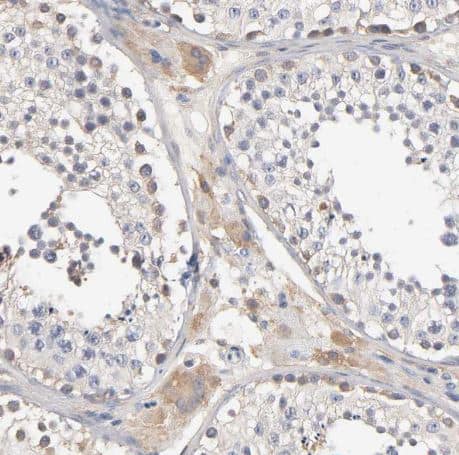 Aldolase A Antibody Aldolase A Antibody