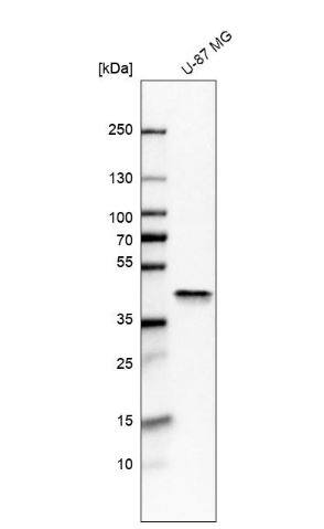 Aldolase A Antibody Aldolase A Antibody