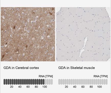 Guanine deaminase Antibody