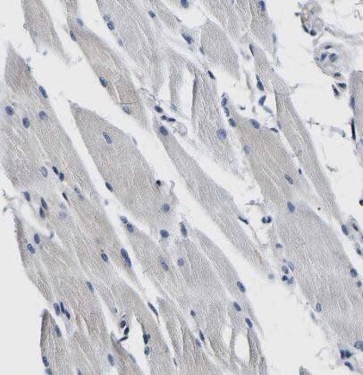 Aconitase 1 Antibody