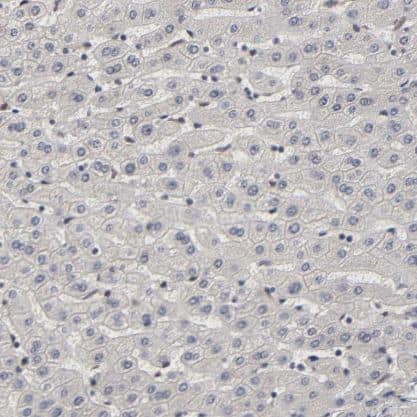 KAT3B/p300 Antibody
