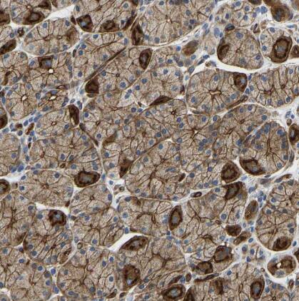 Myosin 1C Antibody