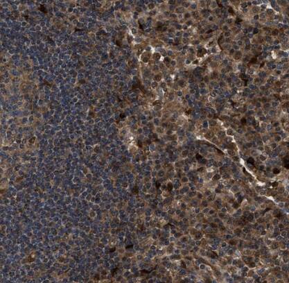 Inorganic Pyrophosphatase/PPA1 Antibody