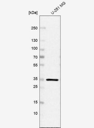 Inorganic Pyrophosphatase/PPA1 Antibody