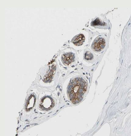 TAK1 Antibody - BSA Free
