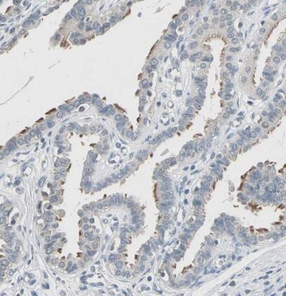 TAK1 Antibody - BSA Free