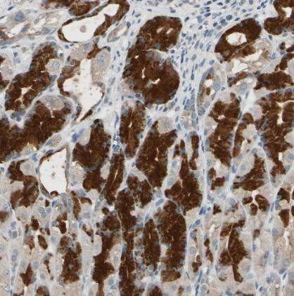 TAK1 Antibody - BSA Free