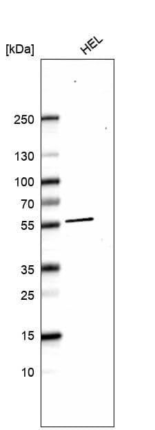 XK X-linked Kx blood group Antibody Western Blot: XK X-linked Kx blood group Antibody [NBP1-87828] -