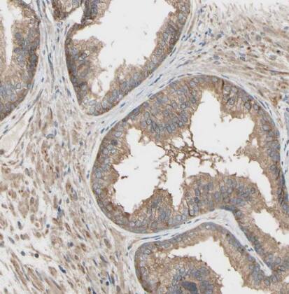 IRAG Antibody - BSA Free