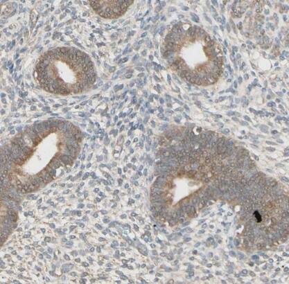 IRAG Antibody - BSA Free