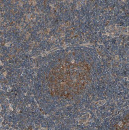 IRAG Antibody - BSA Free