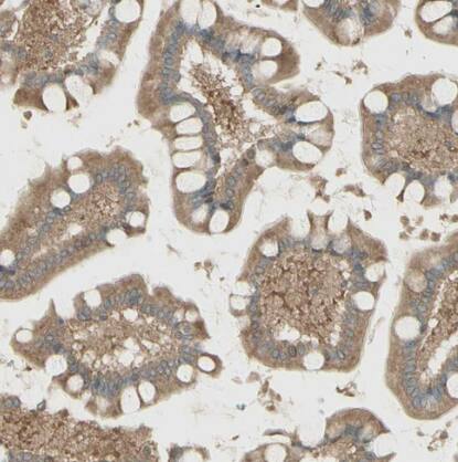 IRAG Antibody - BSA Free