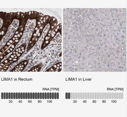 EPLIN Antibody