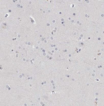 Th-POK Antibody