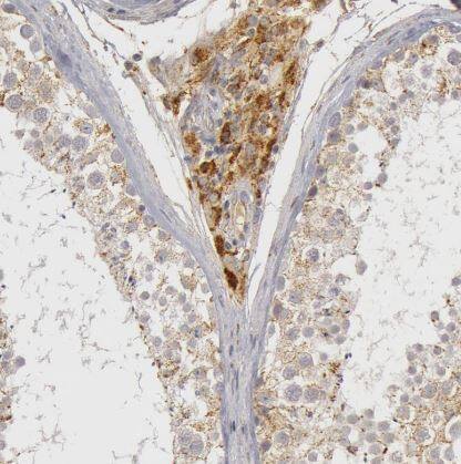 Complement C7 Antibody
