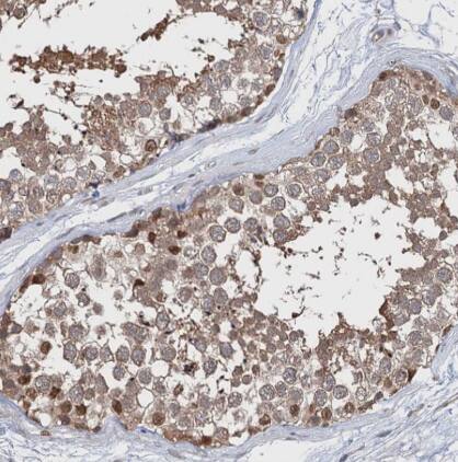 CNAP1 Antibody