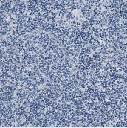 Carbonic Anhydrase IV/CA4 Antibody